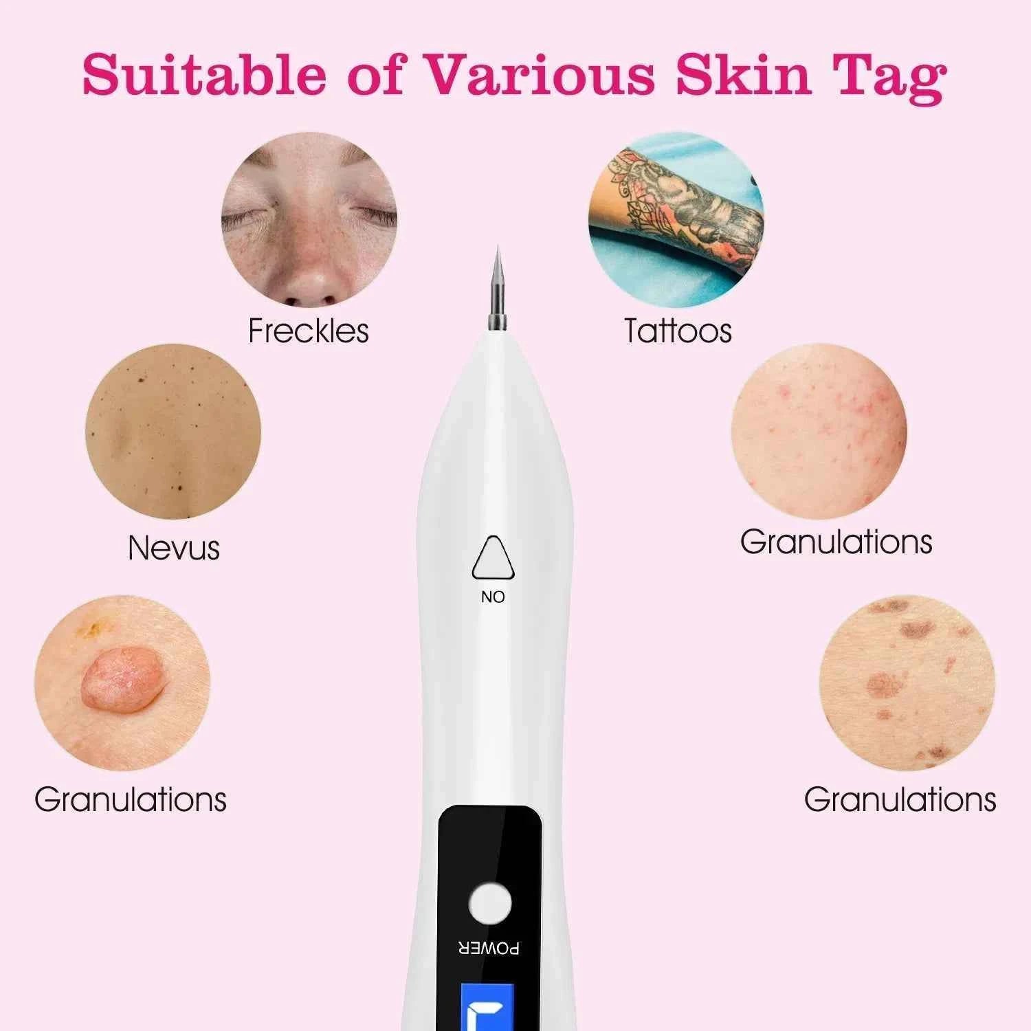 USB Charging Rechargeable Skin Tag Remover
