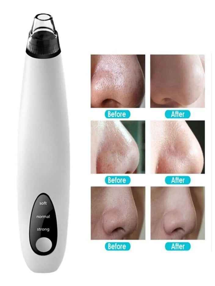 Electric Pore Vacuum Suction Blackhead Remover