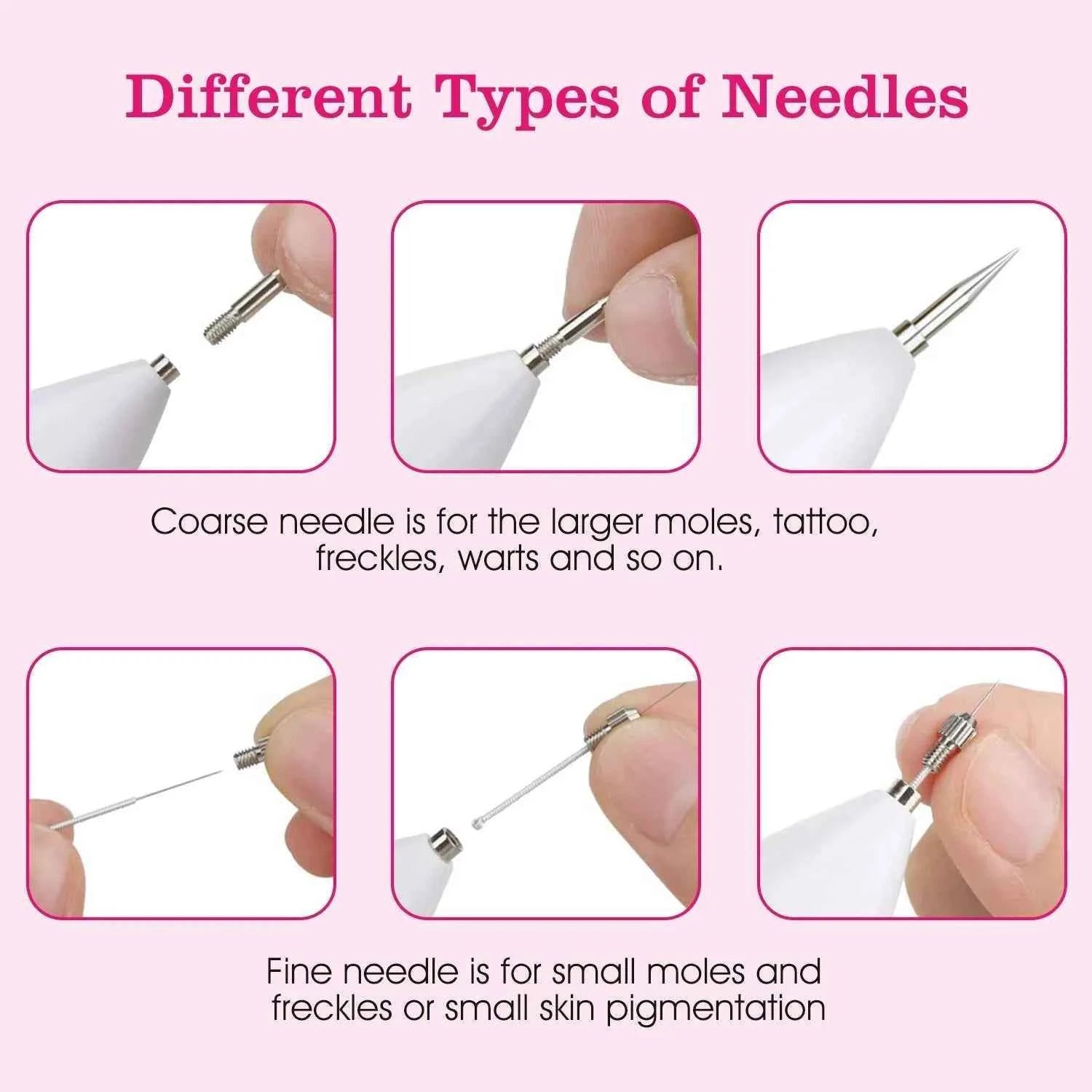 USB Charging Rechargeable Skin Tag Remover