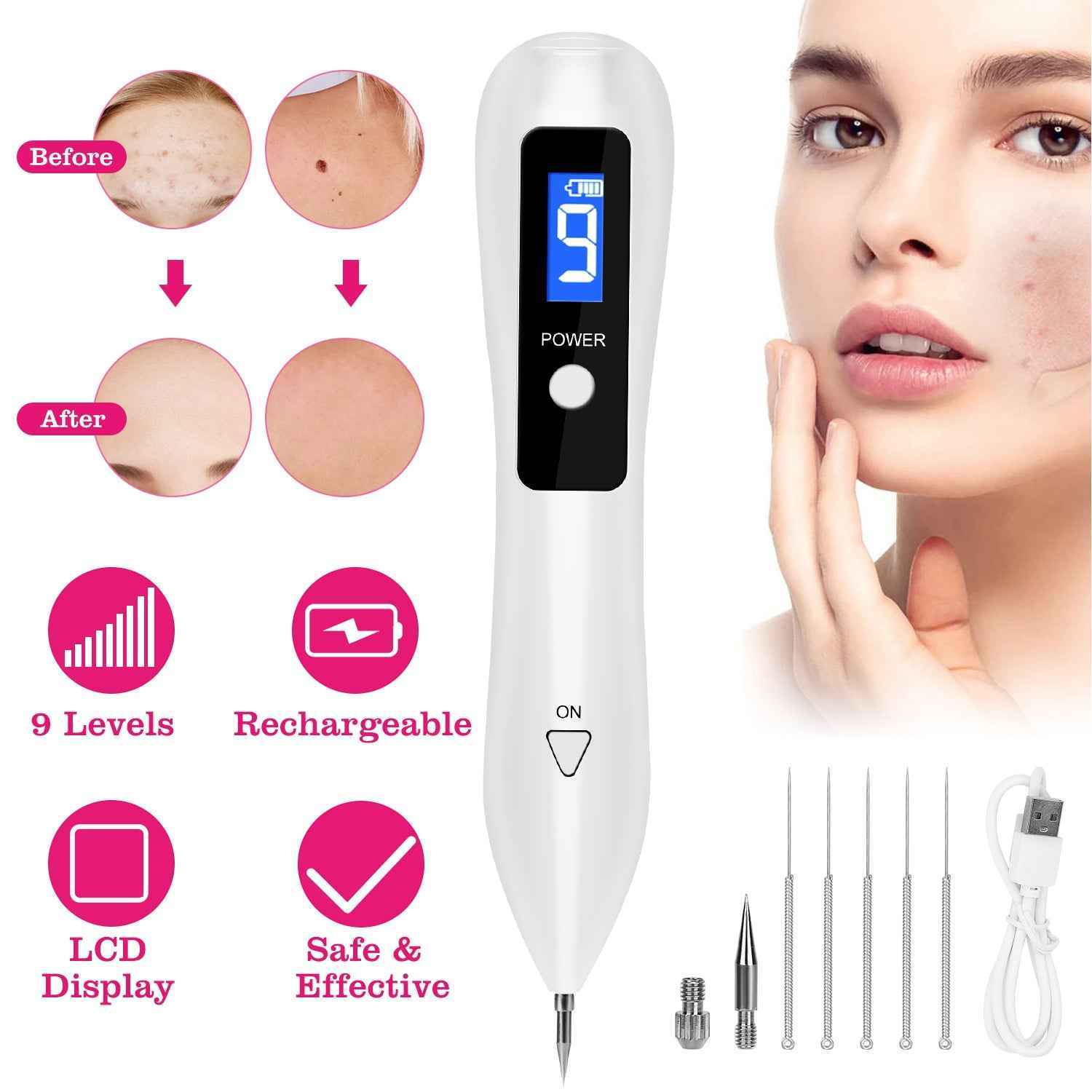 Portable USB Charging Skin Tag Removal Kit