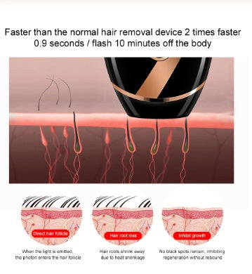 IPL Portable Hair Removal Device - SYVELYA LABS