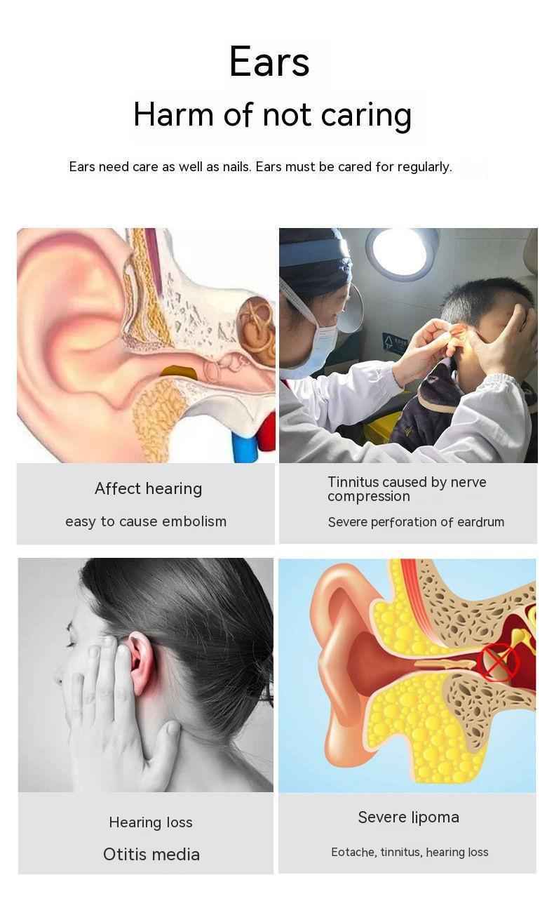 Wireless Smart HD Ear Pick with Luminous Endoscope