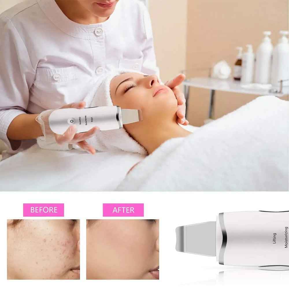 3 in 1 Deep Cleansing Ultrasonic Facial Spatula