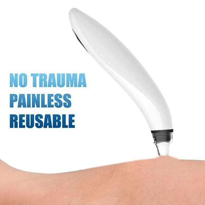 Electric Pore Vacuum Suction Blackhead Remover