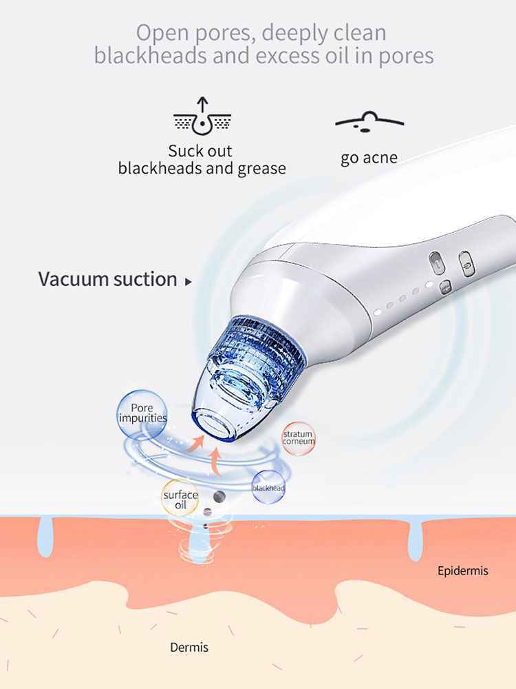 Electric Pore Cleansing Vacuum - 5-in-1 Facial Suction & Exfoliation Device - SYVELYA LABS