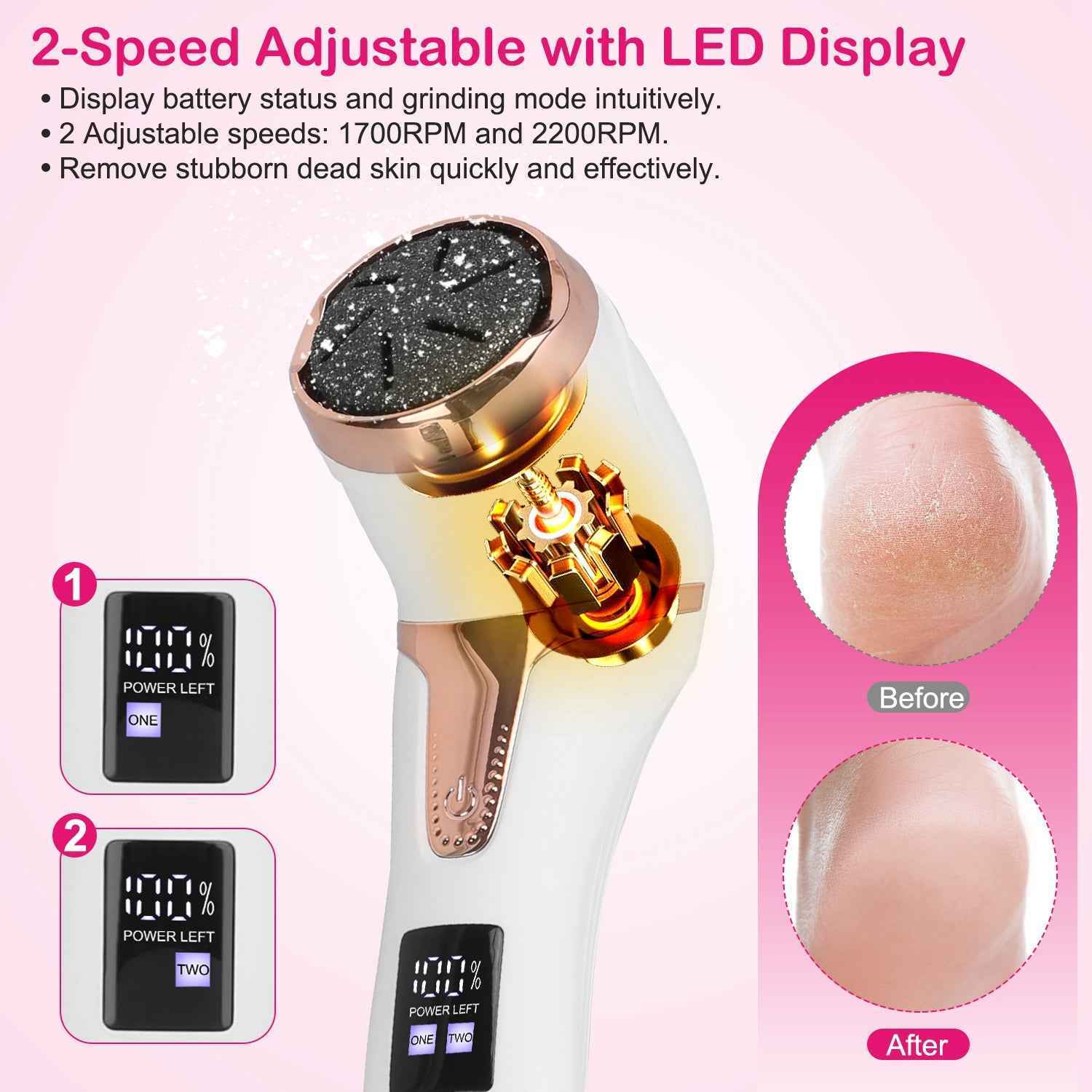 Rechargeable Electric Foot Callus Remover Foot File with Vacuum - 17 Pieces Kit