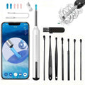 Connected Ear Cleaner with Camera