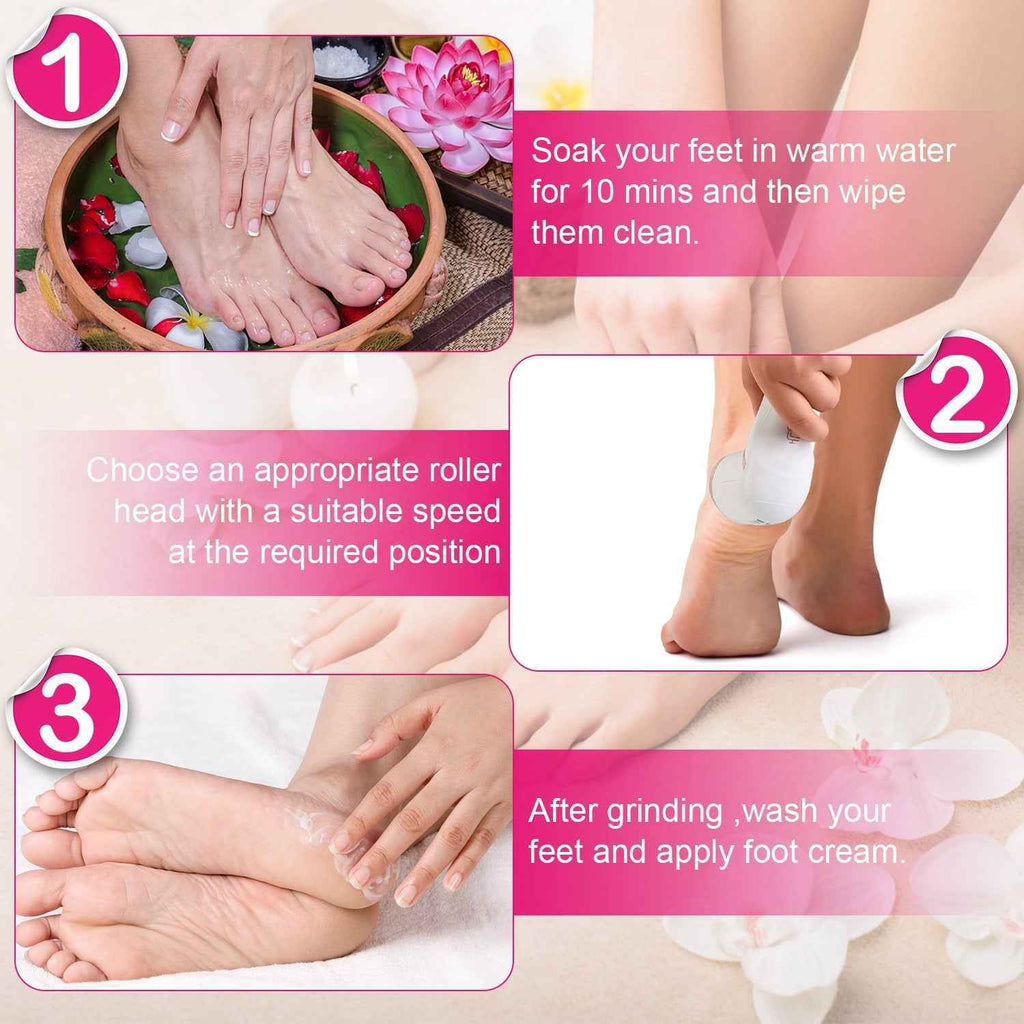 Rechargeable Electric Foot Callus Remover Foot File with Vacuum - 17 Pieces Kit